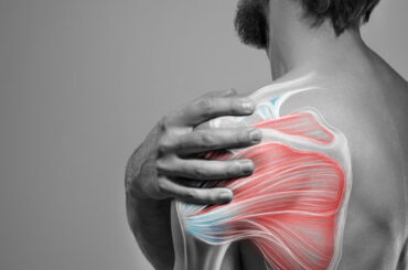 Brachial Plexus Block