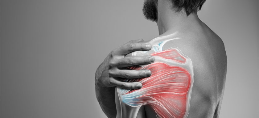 Brachial Plexus Block