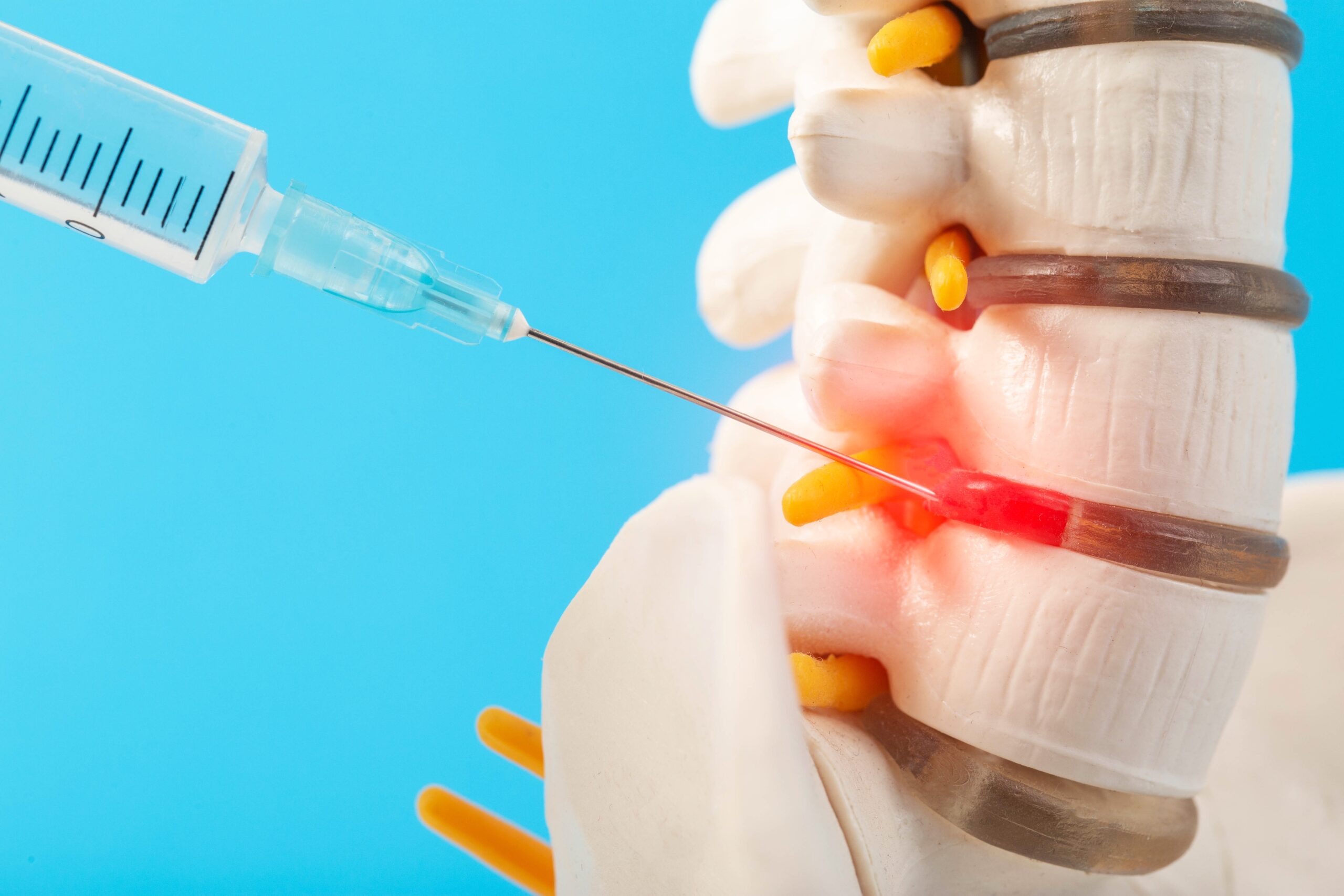 spinal injections