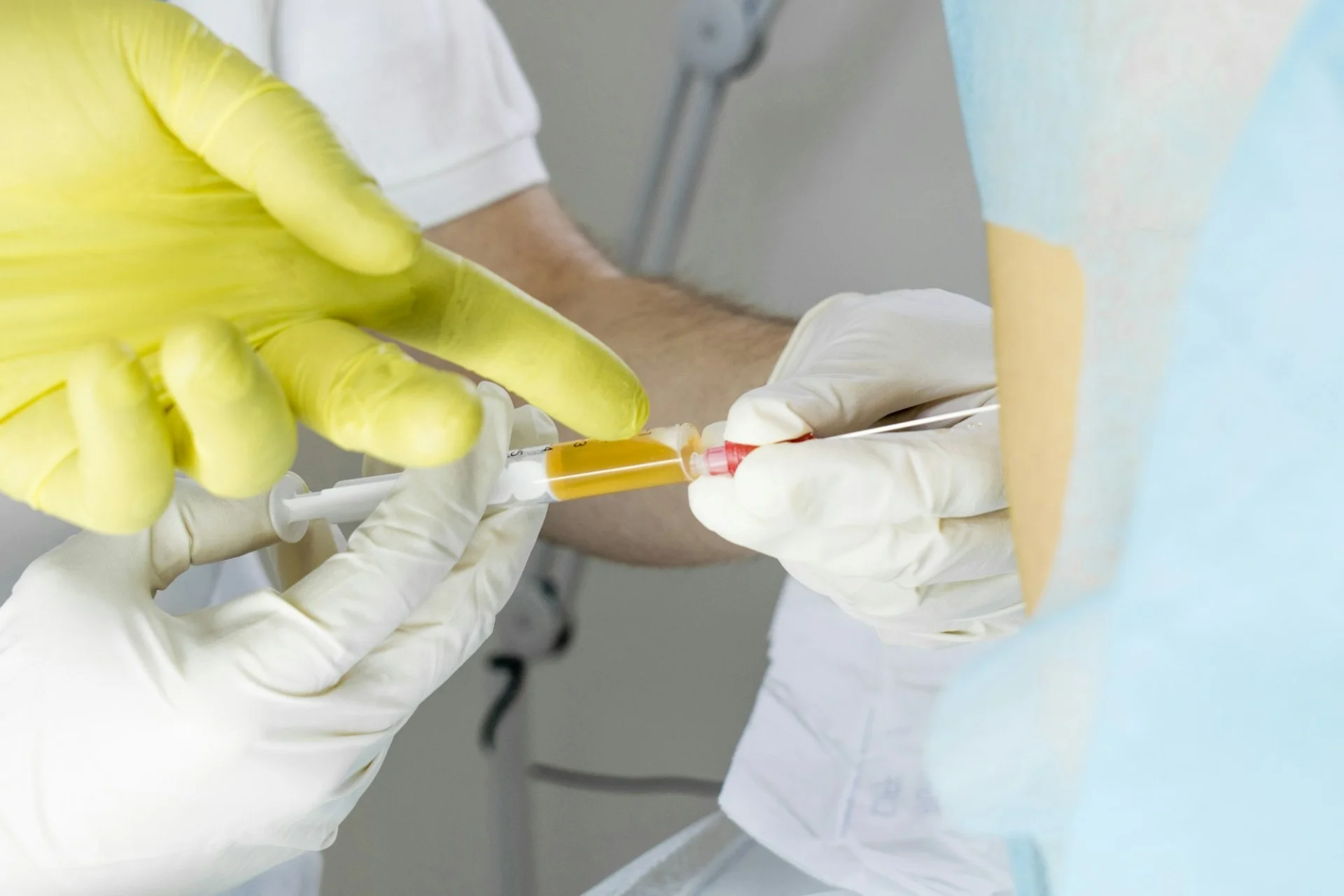 Epidural Steroid Injections